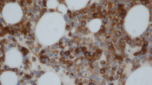 Lunacol de Colway: Lunasina, Lysozima y Beta-glucanos en un solo suplemento
