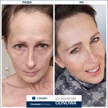 Ampollas Spectrum (2 + 7) | lifting facial sin cirugía | Resultados  en 7 días Ampollas Spectrum (2 + 7) | lifting facial sin cirugía | Resultados  en 7 días