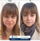 Ampollas Spectrum (2 + 7) | lifting facial sin cirugía | Resultados  en 7 días Ampollas Spectrum (2 + 7) | lifting facial sin cirugía | Resultados  en 7 días