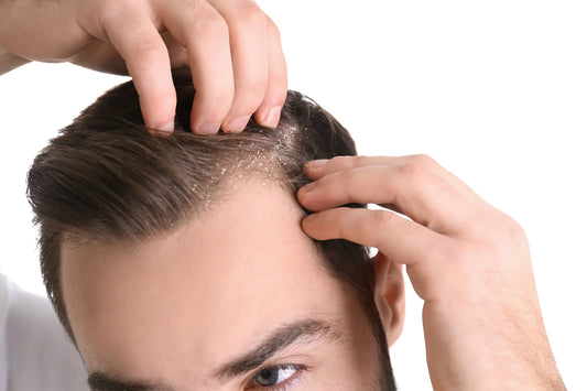 Un análisis comparativo de Procapil y Minoxidil: ¿Cuál es más eficaz para el crecimiento del cabello?