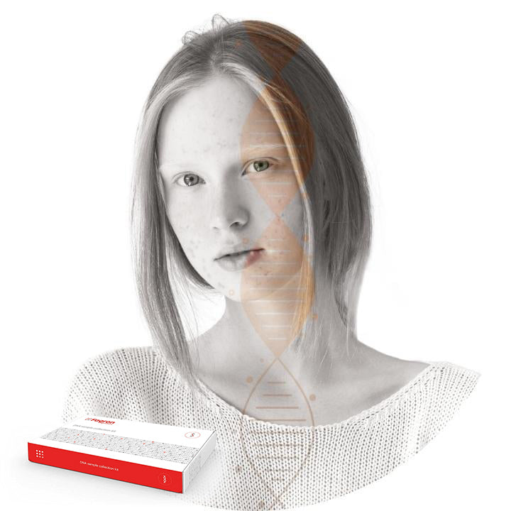 DNA Test for Acne Treatment - Fagron Genomics